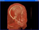     
: Image2.jpg
: 1507
:	57.4 
ID:	13132
